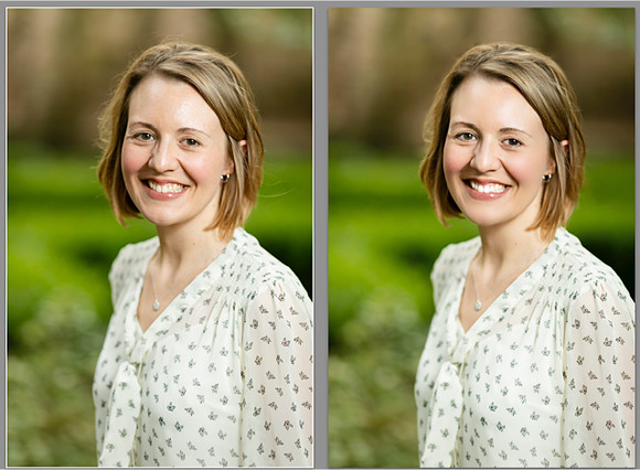Before:After Rachel Accounting